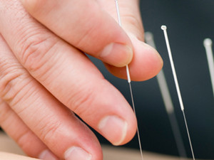 Acupuncture Overview – Why It Works