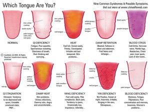 Mirror, Mirror on the Wall: Am I Healthy? Your Tongue Tells All